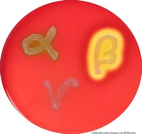Blood Agar and Types of Hemolysis • Microbe Online.
